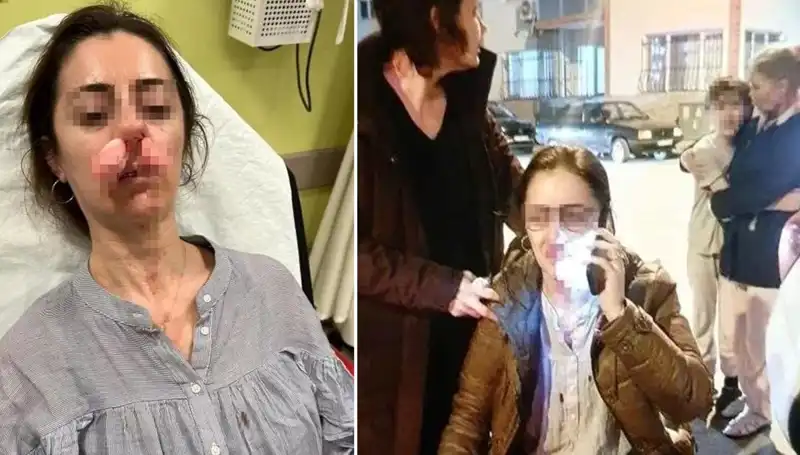 Otomobil Kapısı, Rekor Kıracak Bir Olayda Silah Sayıldı!