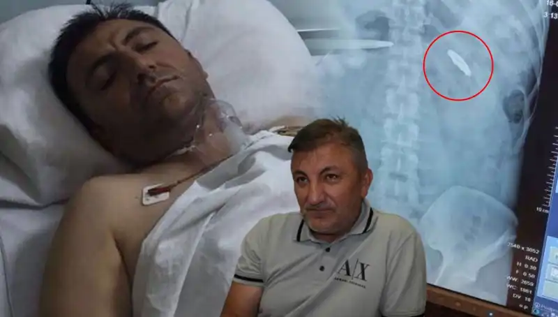 15 Temmuz’un Yol Açtığı Acı Gerçek: Vücudunda Kurşunla Yaşamak